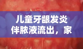 兒童牙齦發(fā)炎伴膿液流出，家長需警惕的口腔健康問題