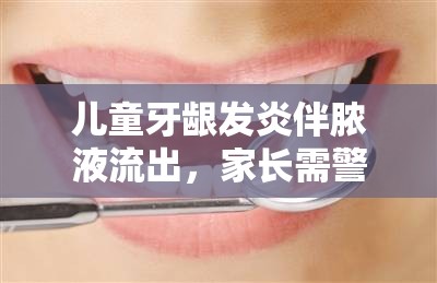 兒童牙齦發(fā)炎伴膿液流出，家長需警惕的口腔健康問題