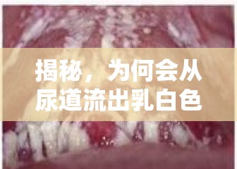 揭秘，為何會從尿道流出乳白色液體？——健康警報與科學解析