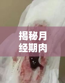揭秘月經(jīng)期肉塊，生理現(xiàn)象的真相與常見(jiàn)誤解