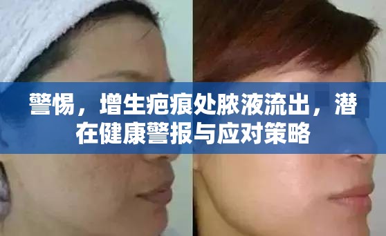 警惕，增生疤痕處膿液流出，潛在健康警報(bào)與應(yīng)對(duì)策略