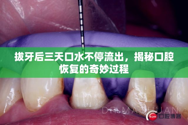 拔牙后三天口水不停流出，揭秘口腔恢復(fù)的奇妙過(guò)程