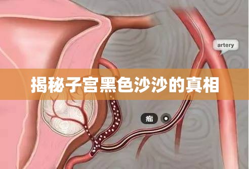 揭秘子宮黑色沙沙的真相
