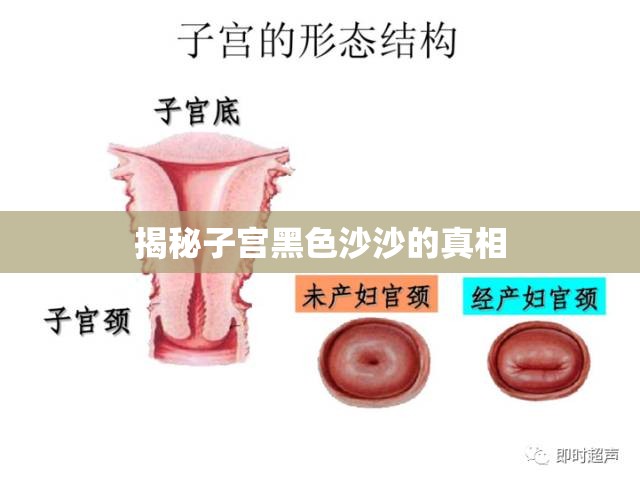 揭秘子宮黑色沙沙的真相