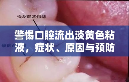 警惕口腔流出淡黃色粘液，癥狀、原因與預防措施