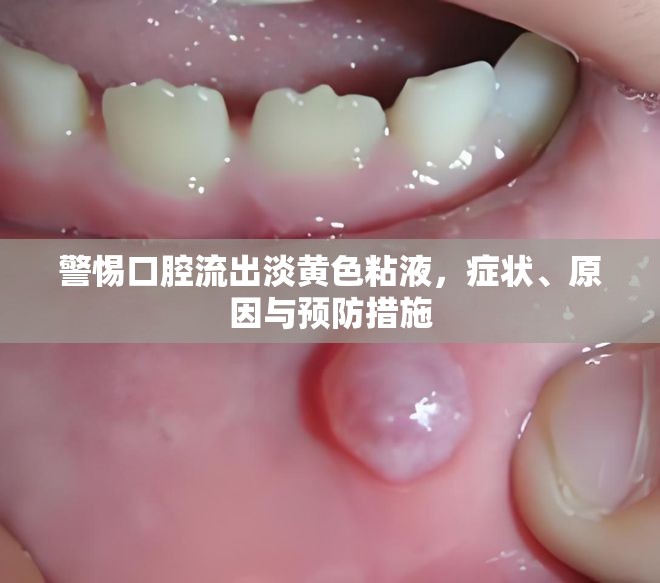 警惕口腔流出淡黃色粘液，癥狀、原因與預防措施