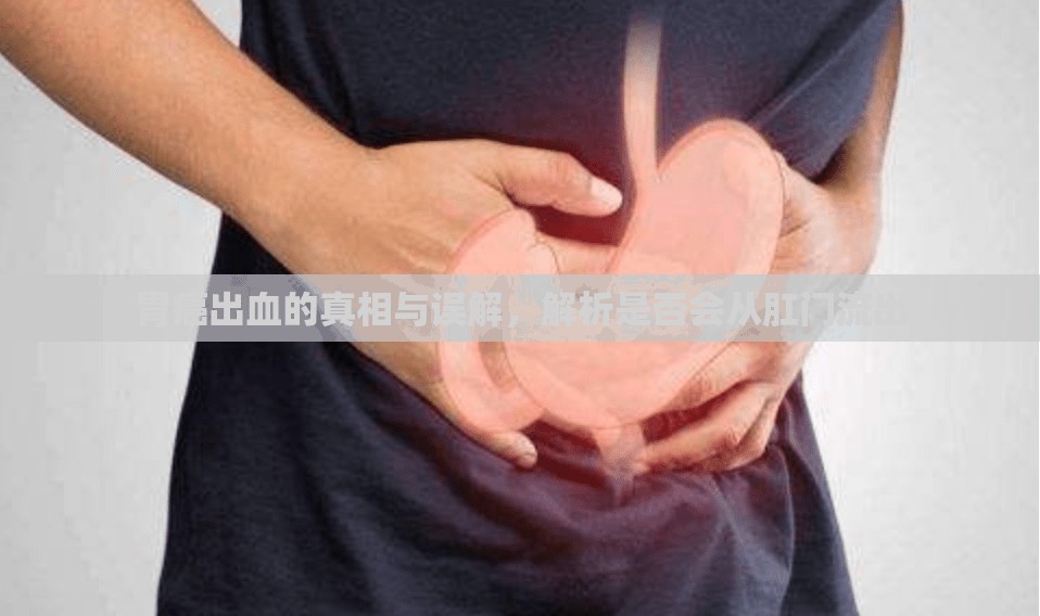 胃癌出血的真相與誤解，解析是否會從肛門流出