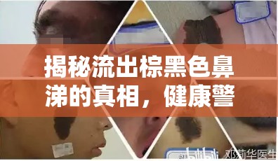 揭秘流出棕黑色鼻涕的真相，健康警報(bào)與應(yīng)對策略