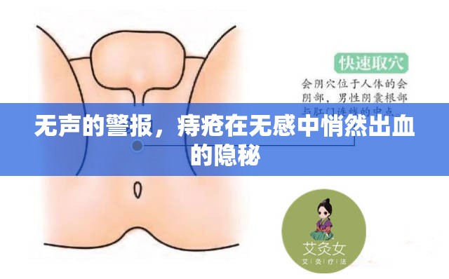 無(wú)聲的警報(bào)，痔瘡在無(wú)感中悄然出血的隱秘
