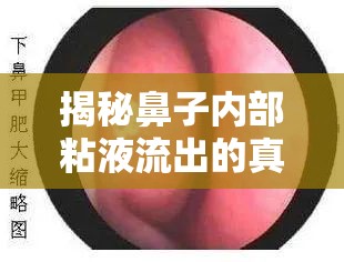 揭秘鼻子內(nèi)部粘液流出的真相與應(yīng)對策略