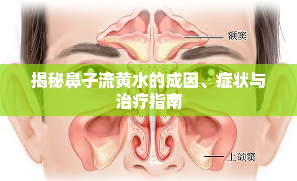 揭秘鼻子流黃水的成因、癥狀與治療指南