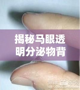 揭秘馬眼透明分泌物背后的真相