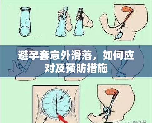 避孕套意外滑落，如何應(yīng)對(duì)及預(yù)防措施