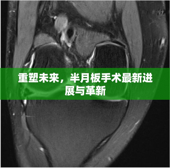 重塑未來(lái)，半月板手術(shù)最新進(jìn)展與革新