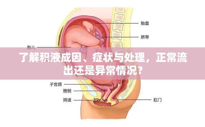 了解積液成因、癥狀與處理，正常流出還是異常情況？