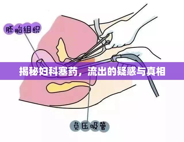 揭秘婦科塞藥，流出的疑惑與真相