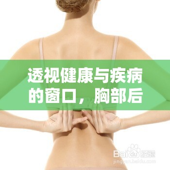 透視健康與疾病的窗口，胸部后前位曝光的重要性