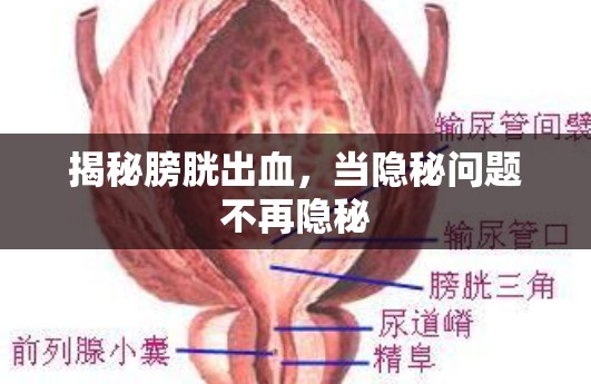 揭秘膀胱出血，當(dāng)隱秘問題不再隱秘