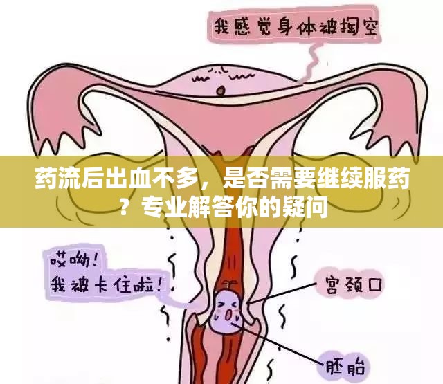 藥流后出血不多，是否需要繼續(xù)服藥？專業(yè)解答你的疑問