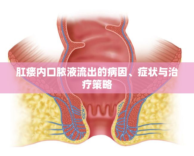 肛瘺內(nèi)口膿液流出的病因、癥狀與治療策略