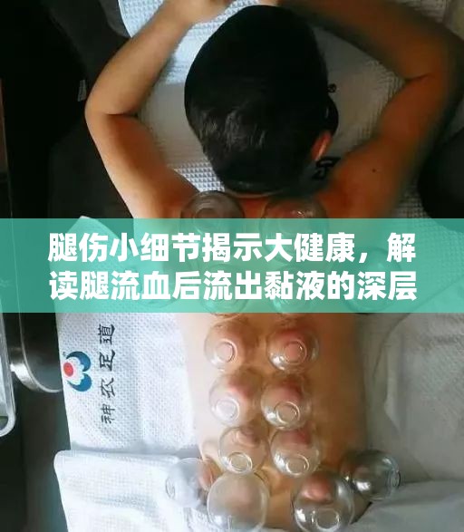腿傷小細(xì)節(jié)揭示大健康，解讀腿流血后流出黏液的深層含義