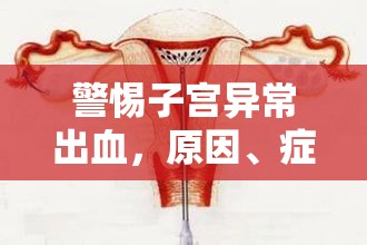 警惕子宮異常出血，原因、癥狀與應對策略