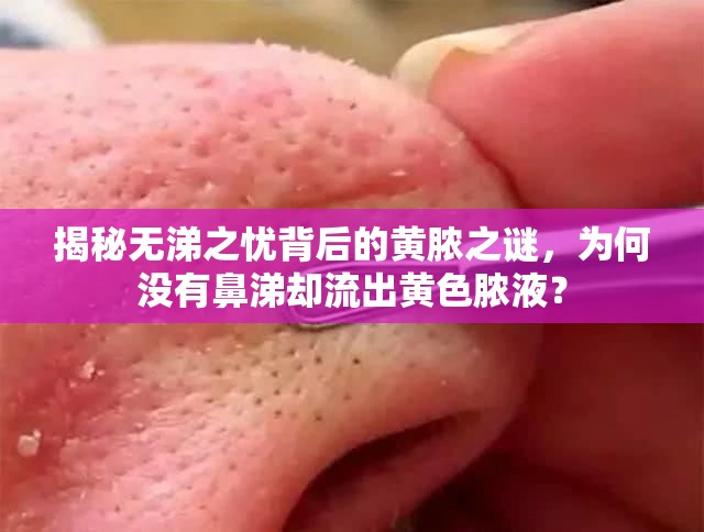 揭秘無涕之憂背后的黃膿之謎，為何沒有鼻涕卻流出黃色膿液？