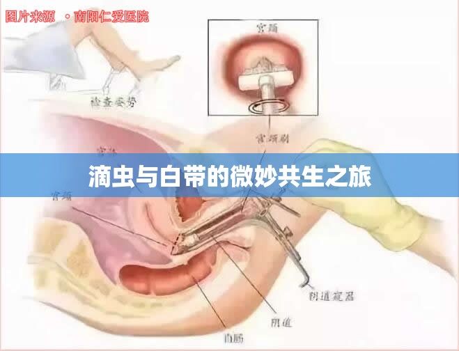 滴蟲(chóng)與白帶的微妙共生之旅