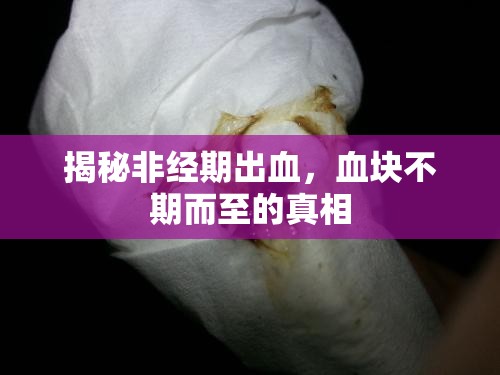 揭秘非經(jīng)期出血，血塊不期而至的真相