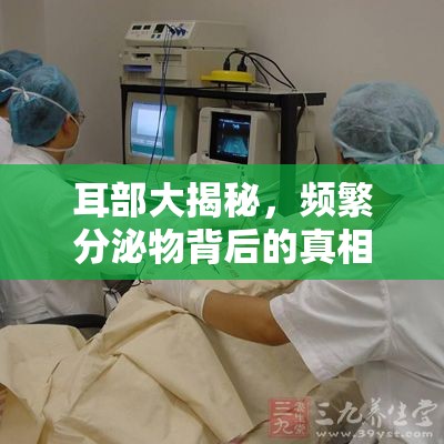 耳部大揭秘，頻繁分泌物背后的真相