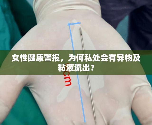 女性健康警報(bào)，為何私處會(huì)有異物及粘液流出？