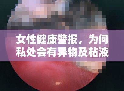 女性健康警報(bào)，為何私處會(huì)有異物及粘液流出？