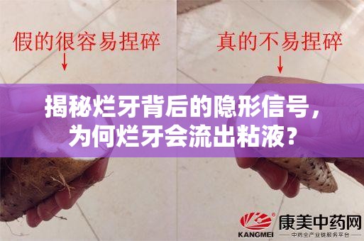 揭秘爛牙背后的隱形信號(hào)，為何爛牙會(huì)流出粘液？