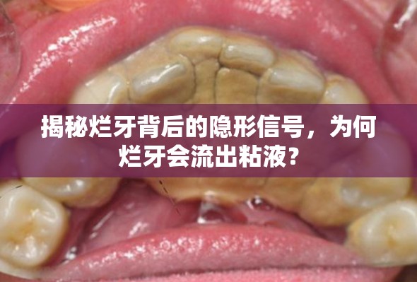 揭秘爛牙背后的隱形信號(hào)，為何爛牙會(huì)流出粘液？