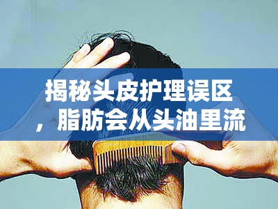 揭秘頭皮護(hù)理誤區(qū)，脂肪會(huì)從頭油里流出來嗎？