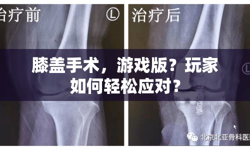 膝蓋手術(shù)，游戲版？玩家如何輕松應(yīng)對？